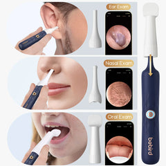 A Photo Of Bebird EarSight Plus Smart Visual Ear Cleaner - Advanced, Portable, and Precise