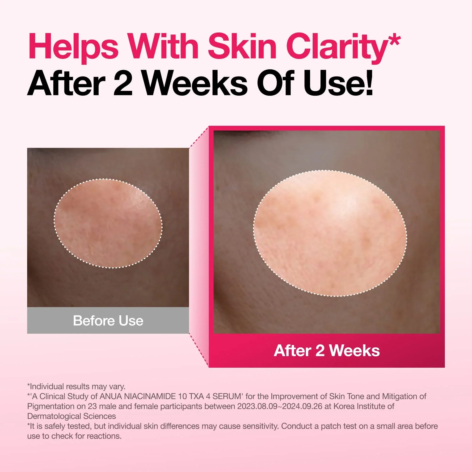 A Photo Of Anua Niacinamide 10% + TXA 4% Serum for Brightening & Dark Spot Care