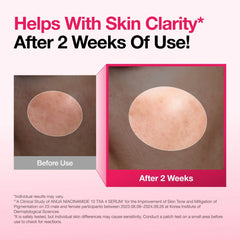 A Photo Of Anua Niacinamide 10% + TXA 4% Serum for Brightening & Dark Spot Care