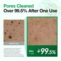 A Photo Of Anua Heartleaf Quercetinol Pore Deep Cleansing Foam - 150ml